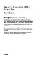 Killey's Fractures of the Mandible. Banks, Peter. Book Cover